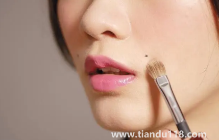 嘴角上面的痣可以點掉嗎（臉上有痣有必要點掉嗎）